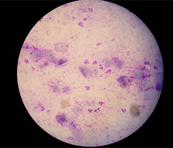犬の細菌性外耳炎の顕微鏡写真