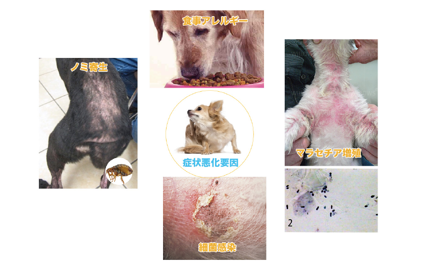 アトピー性皮膚炎の皮膚症状悪化要因のイラスト