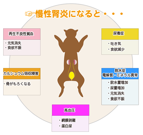慢性腎炎の症状のイラスト