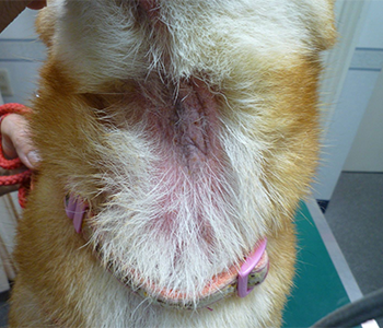 アトピー性皮膚炎の皮膚症状の写真