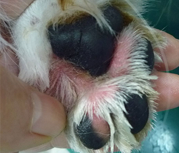 アトピー性皮膚炎による指間湿疹の写真